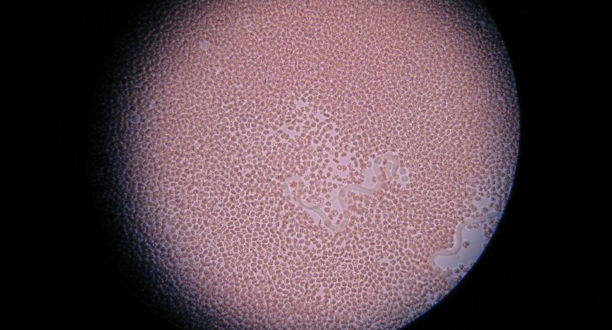 epeúti férgek kezelése a rák klónikus úton terjed